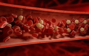 diabetes & circulation issues